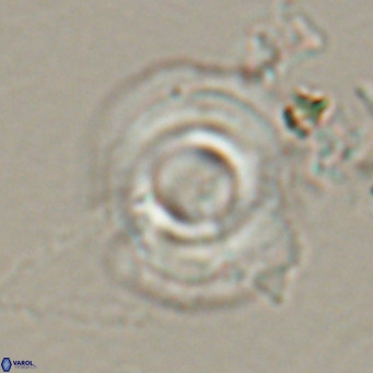 Reticulofenestra laevis VR 026331