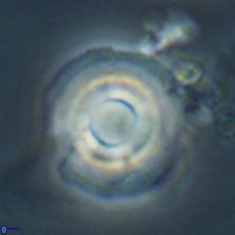 Reticulofenestra laevis VR 026332