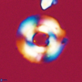 Reticulofenestra laevis VR 026334