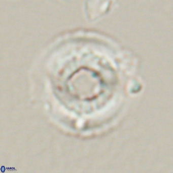 Reticulofenestra laevis VR 026337