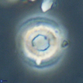 Reticulofenestra laevis VR 026338