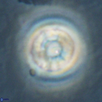 Reticulofenestra laevis VR 026349