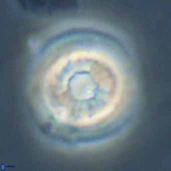 Reticulofenestra laevis VR 026350