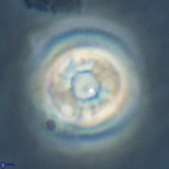 Reticulofenestra laevis VR 026351