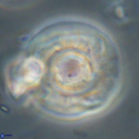 Reticulofenestra laevis VR 30310