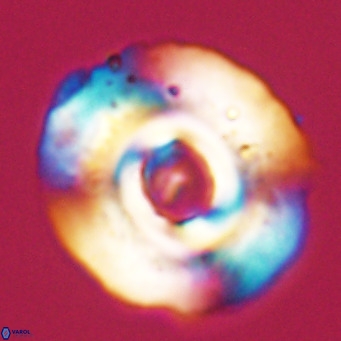 Reticulofenestra lata VR 33144
