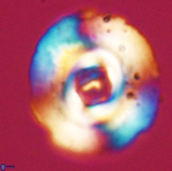 Reticulofenestra lata VR 33147