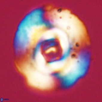 Reticulofenestra lata VR 33148