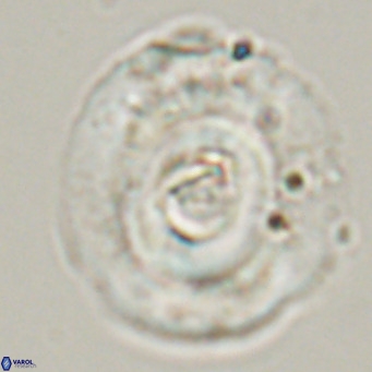 Reticulofenestra lata VR 33152