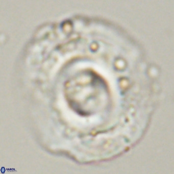Reticulofenestra lata VR 33153