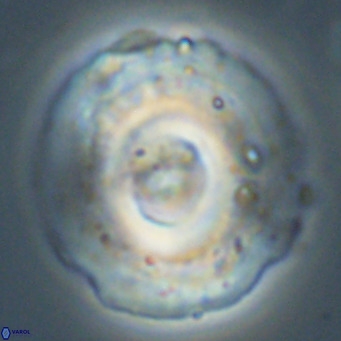 Reticulofenestra lata VR 33155