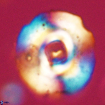 Reticulofenestra lata VR 33157