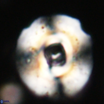 Reticulofenestra lata VR 33158