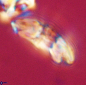 Reticulofenestra lata VR 33161