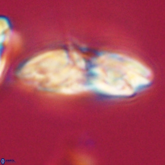 Reticulofenestra lata VR 33163