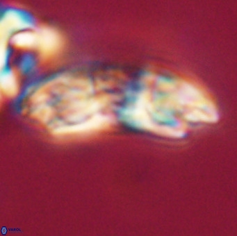 Reticulofenestra lata VR 33172
