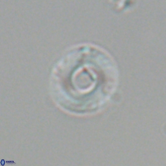 Reticulofenestra looseae 25990