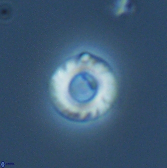 Reticulofenestra looseae 25990