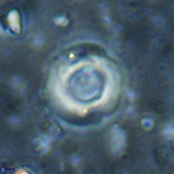Reticulofenestra looseae VR 025498