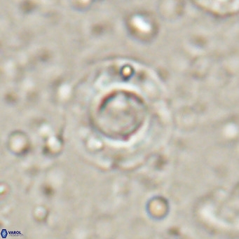 Reticulofenestra looseae VR 025499