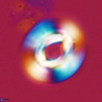 Reticulofenestra pelycomorphus 27465