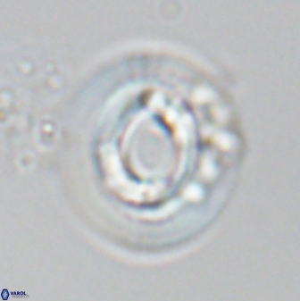 Reticulofenestra pelycomorphus 27467