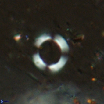 Reticulofenestra pospichalii VR 18085