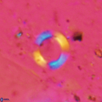 Reticulofenestra pospichalii VR 18086