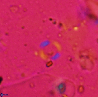 Reticulofenestra pospichalii 30495