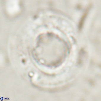 Reticulofenestra primitiva VR 024806