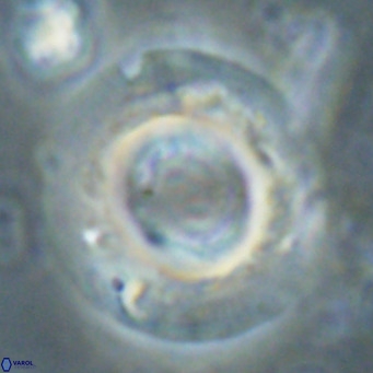 Reticulofenestra primitiva VR 024807