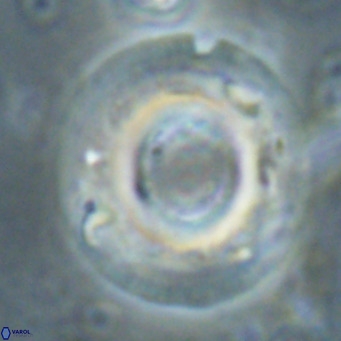 Reticulofenestra primitiva VR 024808