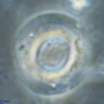 Reticulofenestra primitiva VR 024809