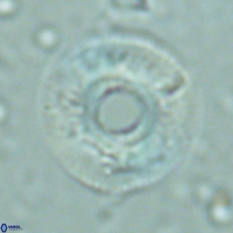 Reticulofenestra primitiva VR 02496