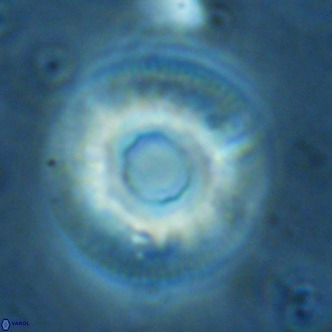 Reticulofenestra primitiva VR 02497