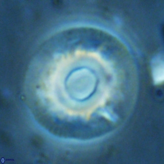 Reticulofenestra primitiva VR 02499