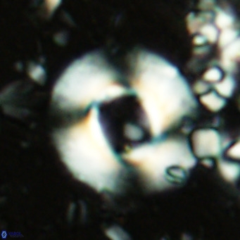 Reticulofenestra primitiva VR 02516