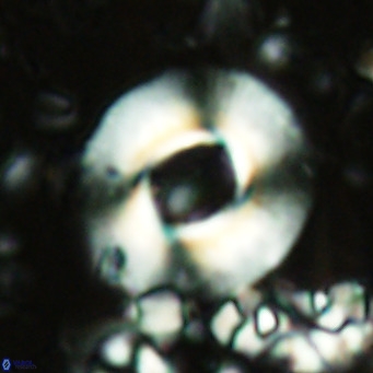 Reticulofenestra primitiva VR 02521