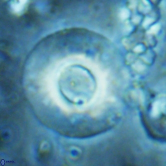 Reticulofenestra primitiva VR 02530