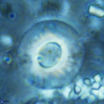 Reticulofenestra primitiva VR 02532