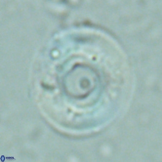 Reticulofenestra primitiva VR 02600