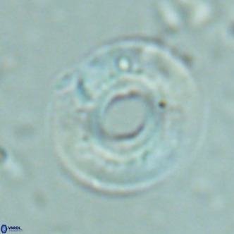Reticulofenestra primitiva VR 02601