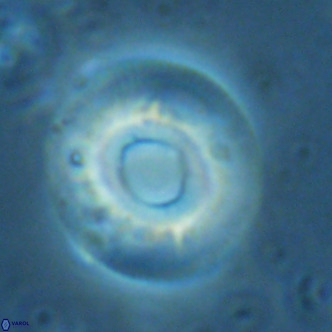 Reticulofenestra primitiva VR 02604