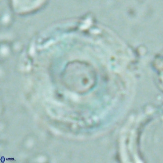 Reticulofenestra primitiva VR 02772