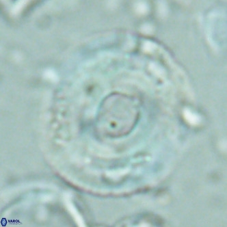 Reticulofenestra primitiva VR 02774