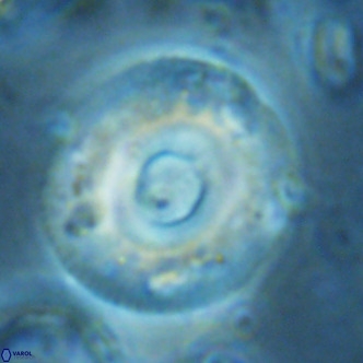 Reticulofenestra primitiva VR 02775