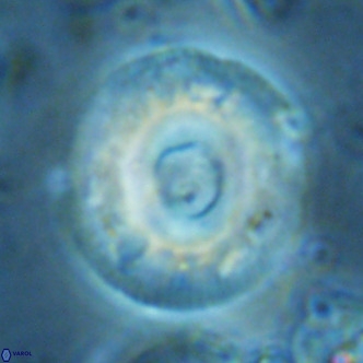Reticulofenestra primitiva VR 02776