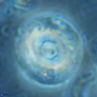 Reticulofenestra primitiva VR 02777