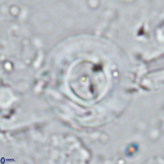 Reticulofenestra primitiva VR 03040