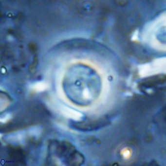 Reticulofenestra primitiva VR 03041